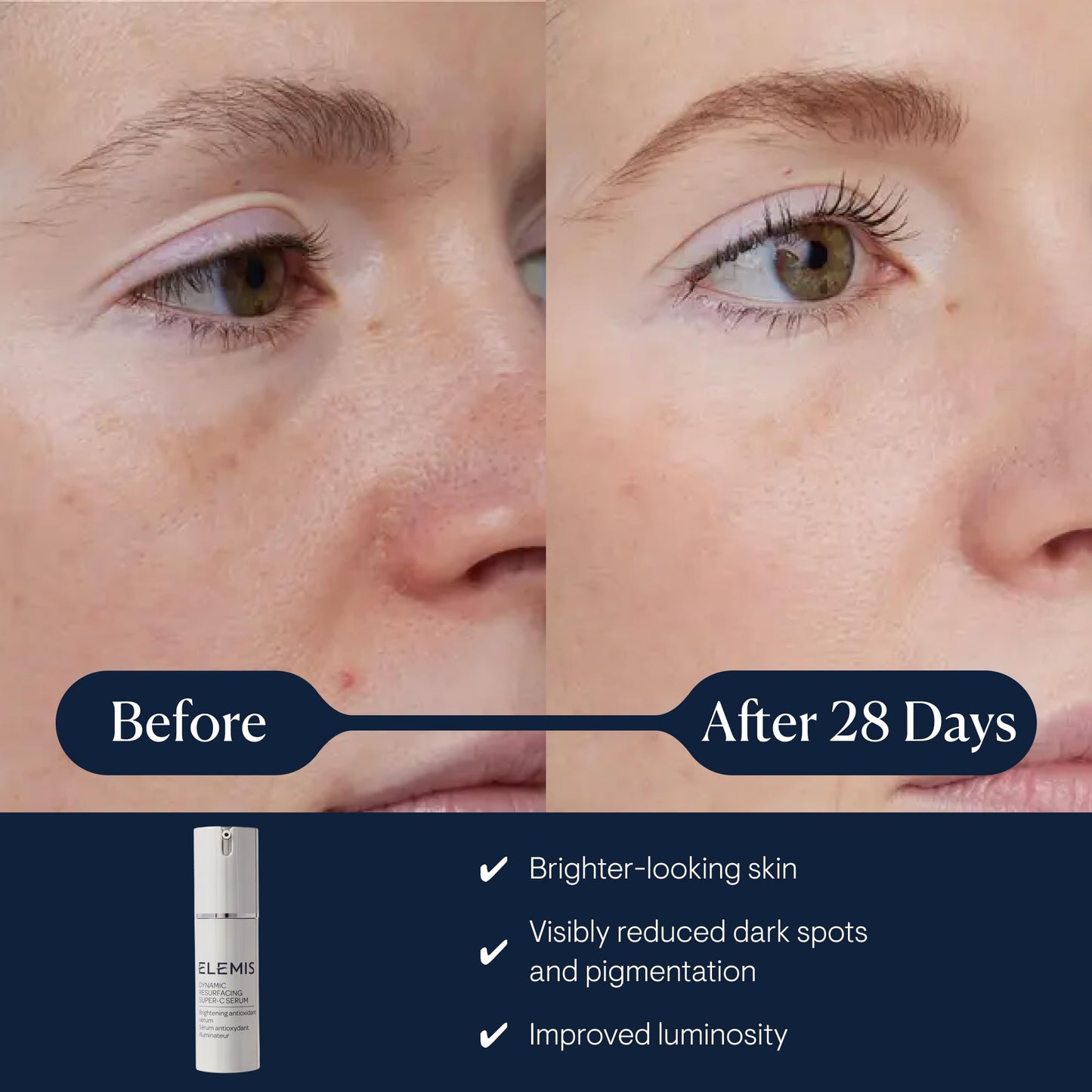 ELEMIS Dynamic Resurfacing Super-C Serum, Daily Anti-Aging Antioxidant Serum Brightens, Refines, and Illuminates Dull Skin with Vitamin C, 30 mL