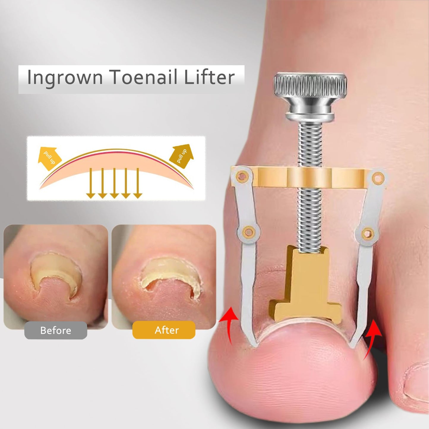Ingrown Toenail Clipper for Men Women Nail Clipper for Senior Thick Toenail Clippers for Ingrown Nails Removal Set Nail Cutter Pedicure Knife Toe Nails Clipper Kit
