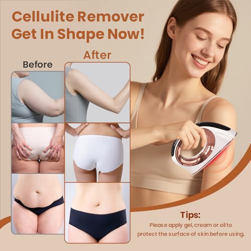 Mozoss Cellulite Massager, Body Sculpting Machine Radio Frequency Device for Body Massage and Cellulite Removal, Suitable Use on Belly, Arm, Waist, Leg