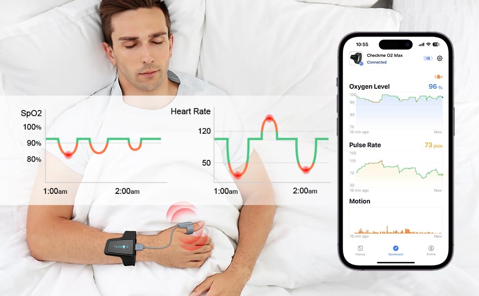 Wellue O2 Pulse Oximeter with Smart Reminder | Blood Oxygen Saturation Monitor for SpO2 and Heart Rate Tracking Continuously, Bluetooth Finger Ring with Free APP &PC Report, Style 1