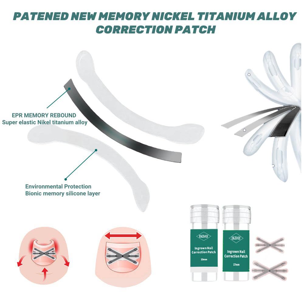 Ingrown Toenail Treatment & Removal Kit (New 6X Tension) at Home Treatment for Toenails,Titanium Alloy Ingrown Toenail Corrector, Nail Tools for Curved Nail Repair for Men Woman (0.67/0.79in)