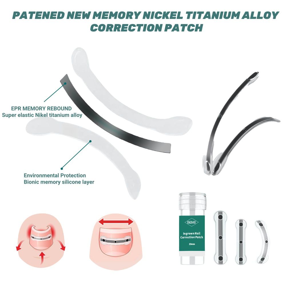 Ingrown Toenail Removal Kit | Titanium Alloy Ingrown Toenail Treatment | Pedicure Tools for Feet, Nail Tools Specially Designed for Curved Nail Repair and Ingrown Toenail Corrector (0.67/0.79in)