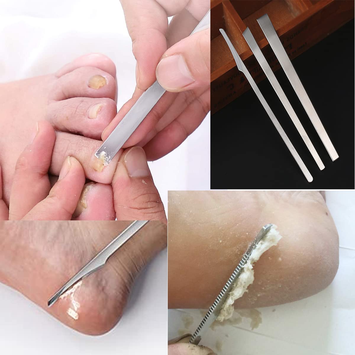ZGGDHSWLLMF Stainless Steel Ingrown Toenail Pedicure Knife Set,Professional Foot Skin Scraper Repair Sharp Blade Kit For Nail Corn Callus Paronychia Treatment. (4)