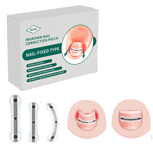 Ingrown Toenail Removal Kit | Titanium Alloy Ingrown Toenail Treatment | Pedicure Tools for Feet, Nail Tools Specially Designed for Curved Nail Repair and Ingrown Toenail Corrector (0.67/0.79in)