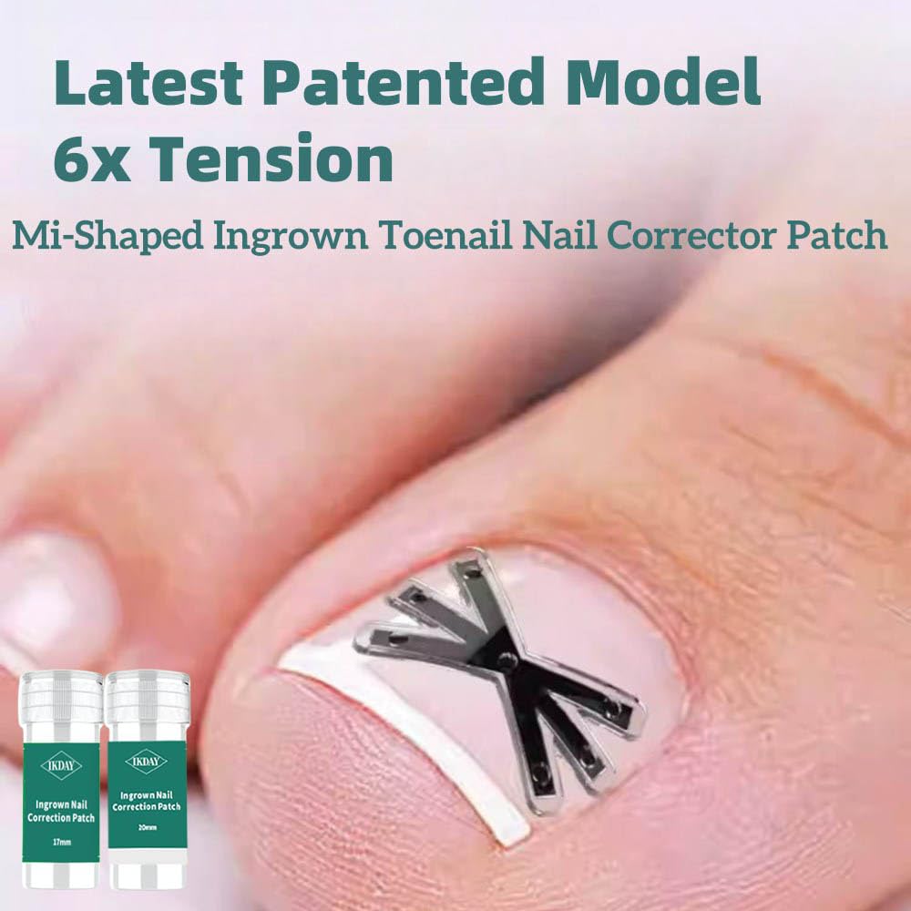 Ingrown Toenail Treatment & Removal Kit (New 6X Tension) at Home Treatment for Toenails,Titanium Alloy Ingrown Toenail Corrector, Nail Tools for Curved Nail Repair for Men Woman (0.67/0.79in)