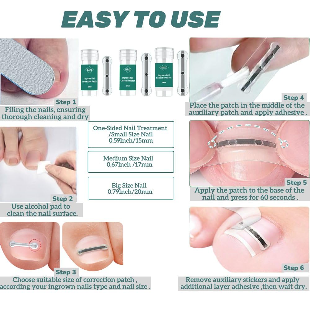 Ingrown Toenail Treatment & Removal Kit - at Home Treatment for Ingrown Toenails, Titanium Alloy Ingrown Toenail Corrector, Nail Tools for Curved Nail Repair Suitable for Men Woman (((0.67/0.79in)))