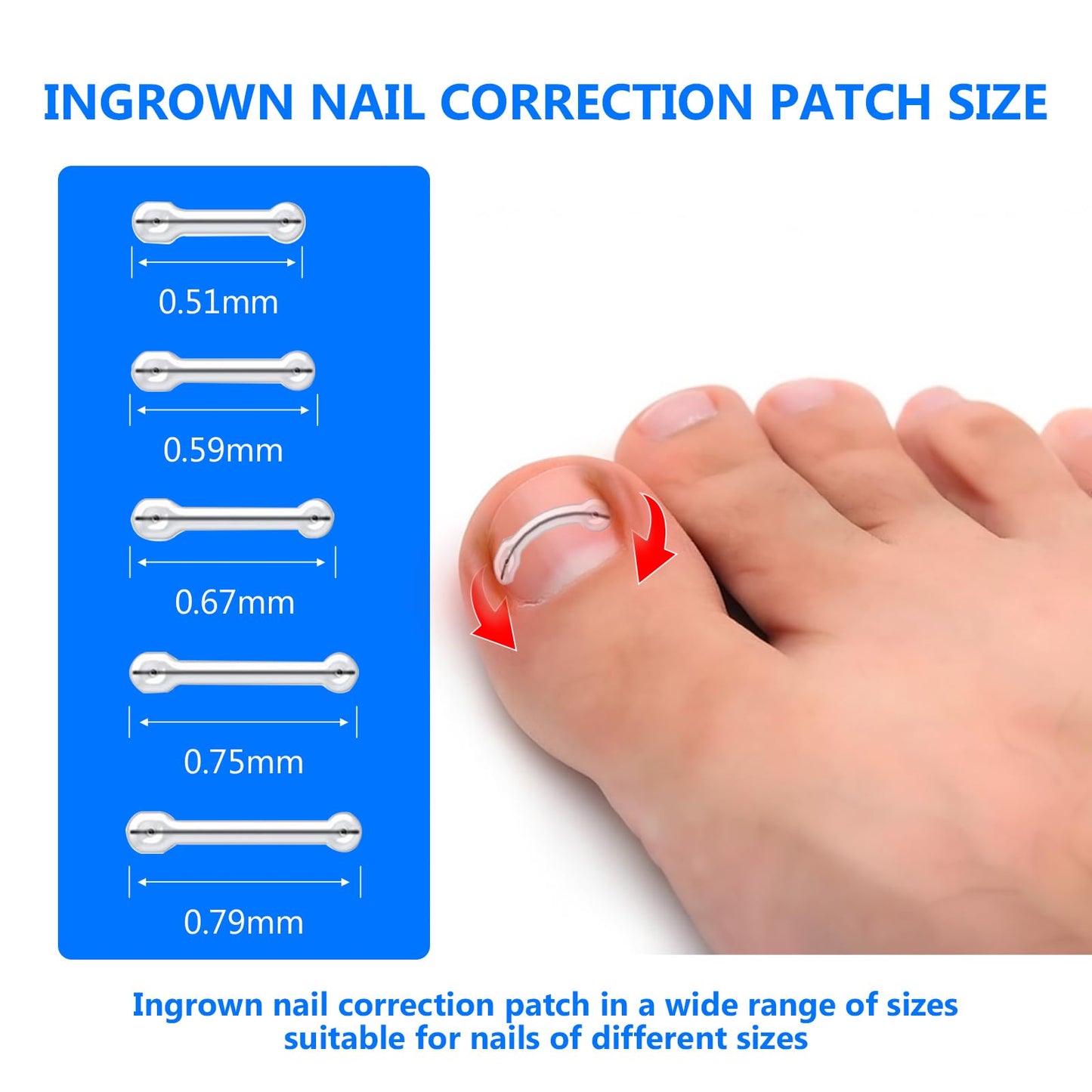 Ingrown Toenail Treatment, Toenail Correction Strips for Curved or Ingrown Nails, Ingrown Toe Nail Relief Remover Strips, Quick Relief, Nail Correction, 5 Different Sizes