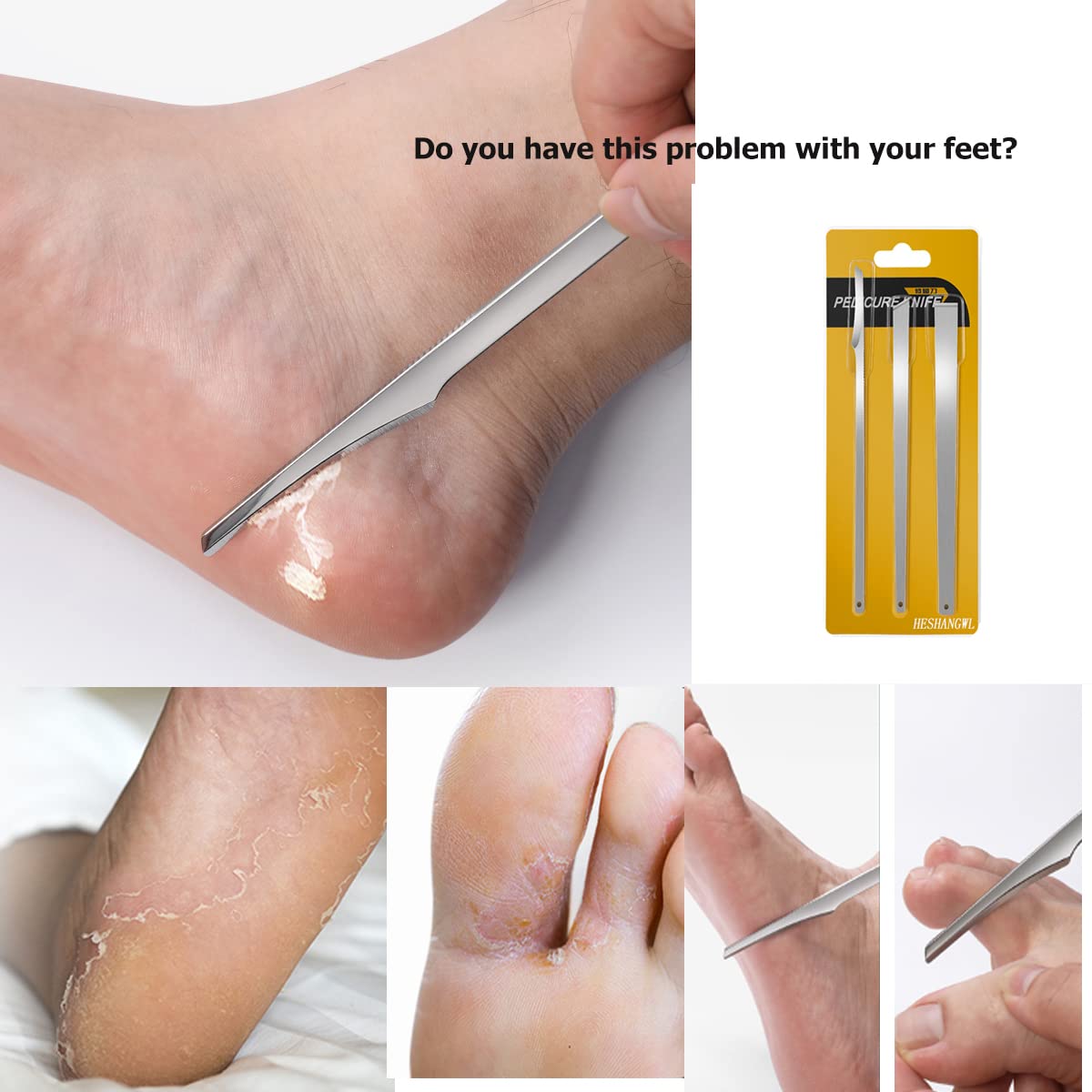 ZGGDHSWLLMF Stainless Steel Ingrown Toenail Pedicure Knife Set,Professional Foot Skin Scraper Repair Sharp Blade Kit For Nail Corn Callus Paronychia Treatment. (4)