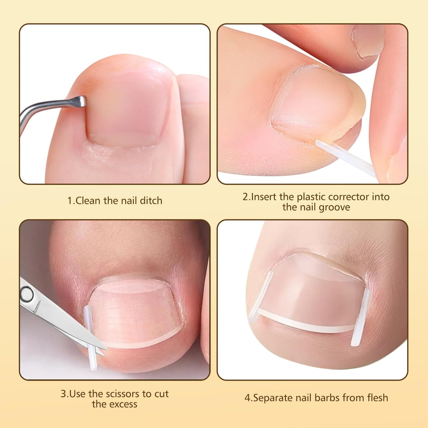 Ingrown Toenail Corrector Set with Magnifier and Correction Strips, Professional Ingrown Toenail Treatment Tools Set, Safe and Effective Nail Care for Home Use