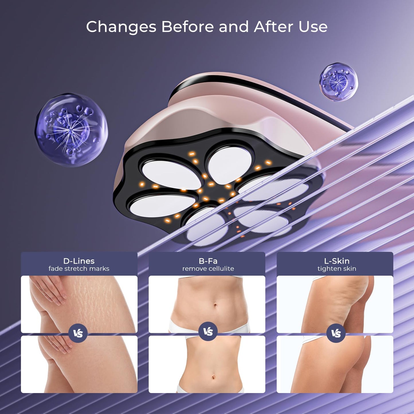 Oranmagic Professional Electric Body Massager Machine- Upgraded Portable Skin Tightening Massager with Heating for Belly, Waist, Arms, Buttocks, Legs, Wireless & Lightweight