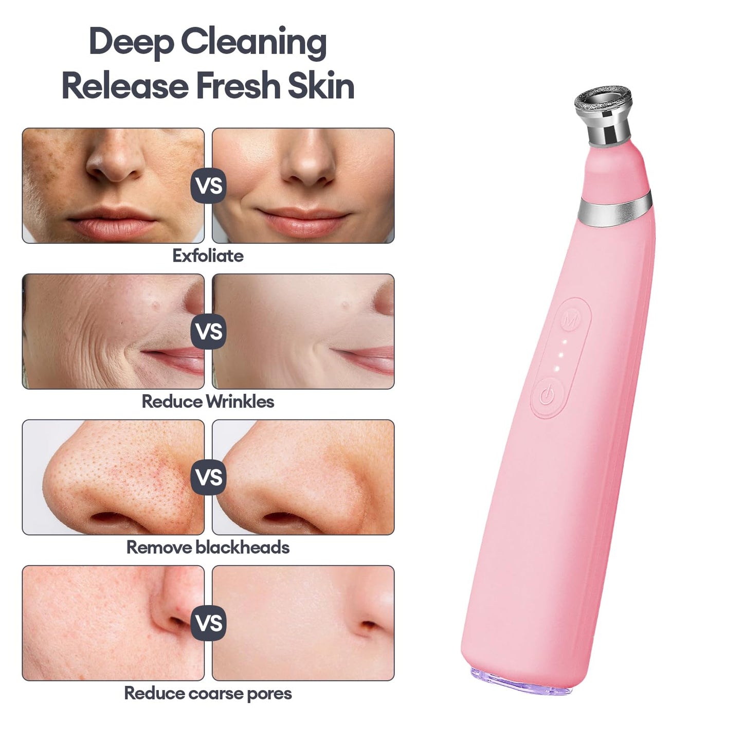 IeBilif Diamond Microdermabrasion Machine, 3 Modes Diamond Microdermabrasion Dermabrasion Machine for Blackhead Removal, Professional Portable Home Travel Microdermabrasion Device