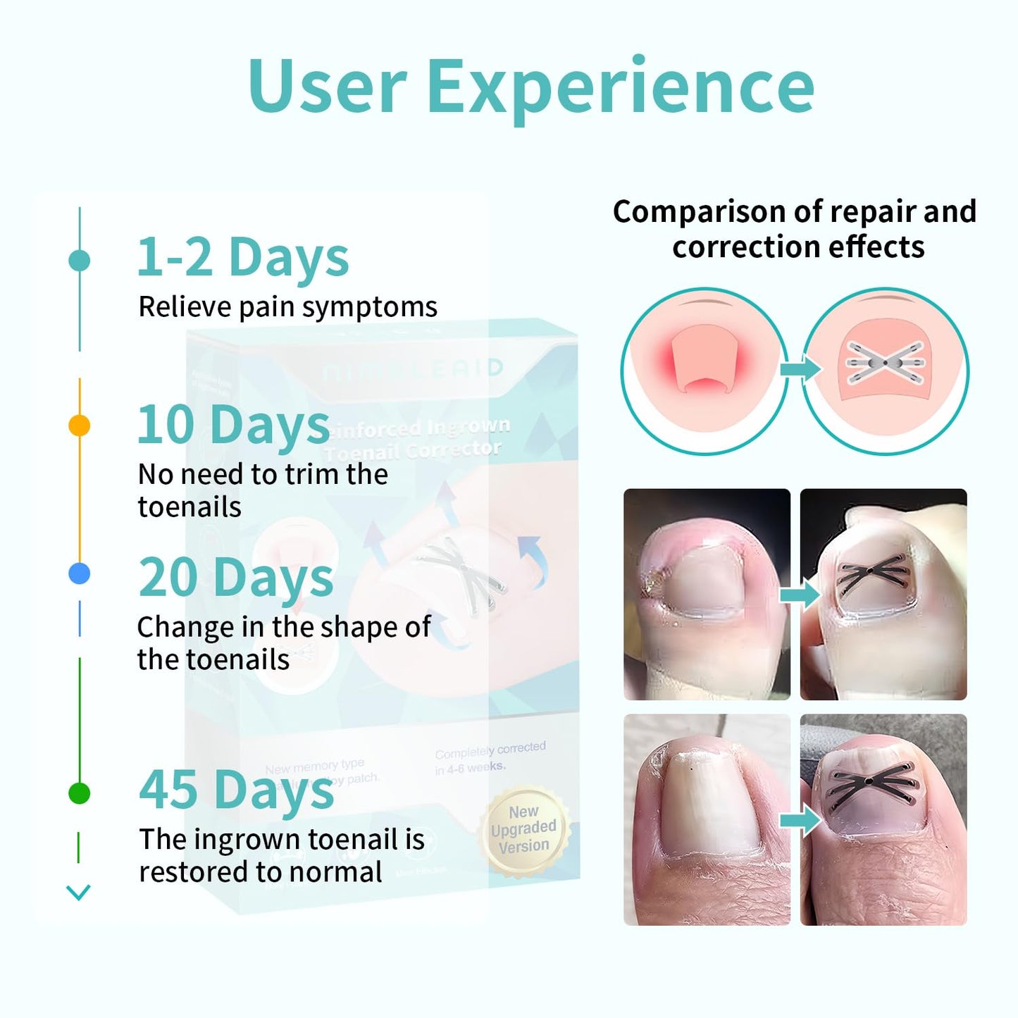 Upgraded Titanium Alloy Ingrown Toenail Corrector with Upgraded 6-Angle Shape,3x Stronger Pull Force,Ingrown Toenail Removal Kit, Ingrown Toenail Treatment for Women and Man