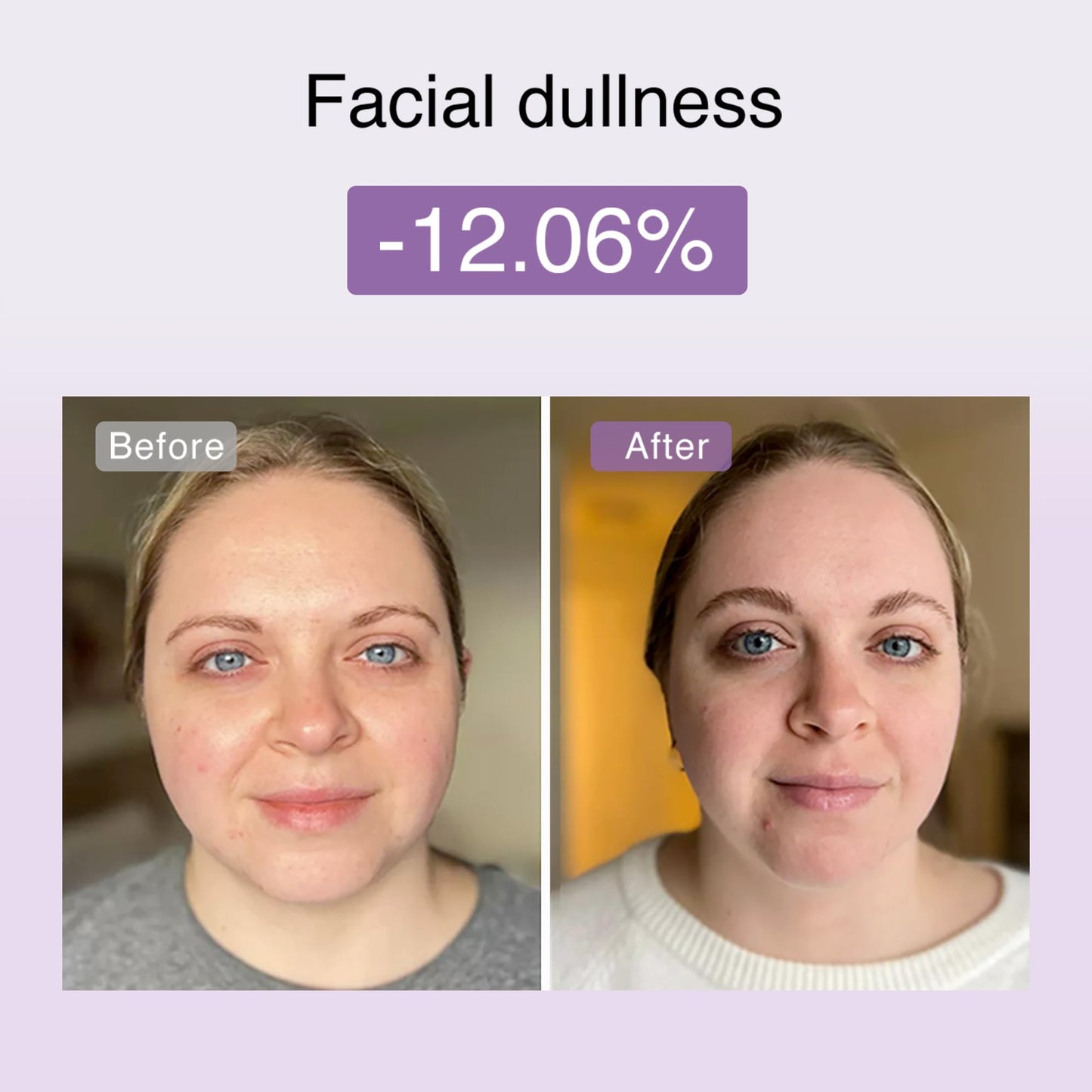 DermRays M1 4-in-1 Facial Toning Tool with Multi-Leading Tech for a Visibly Radiant & Youthful Appearance