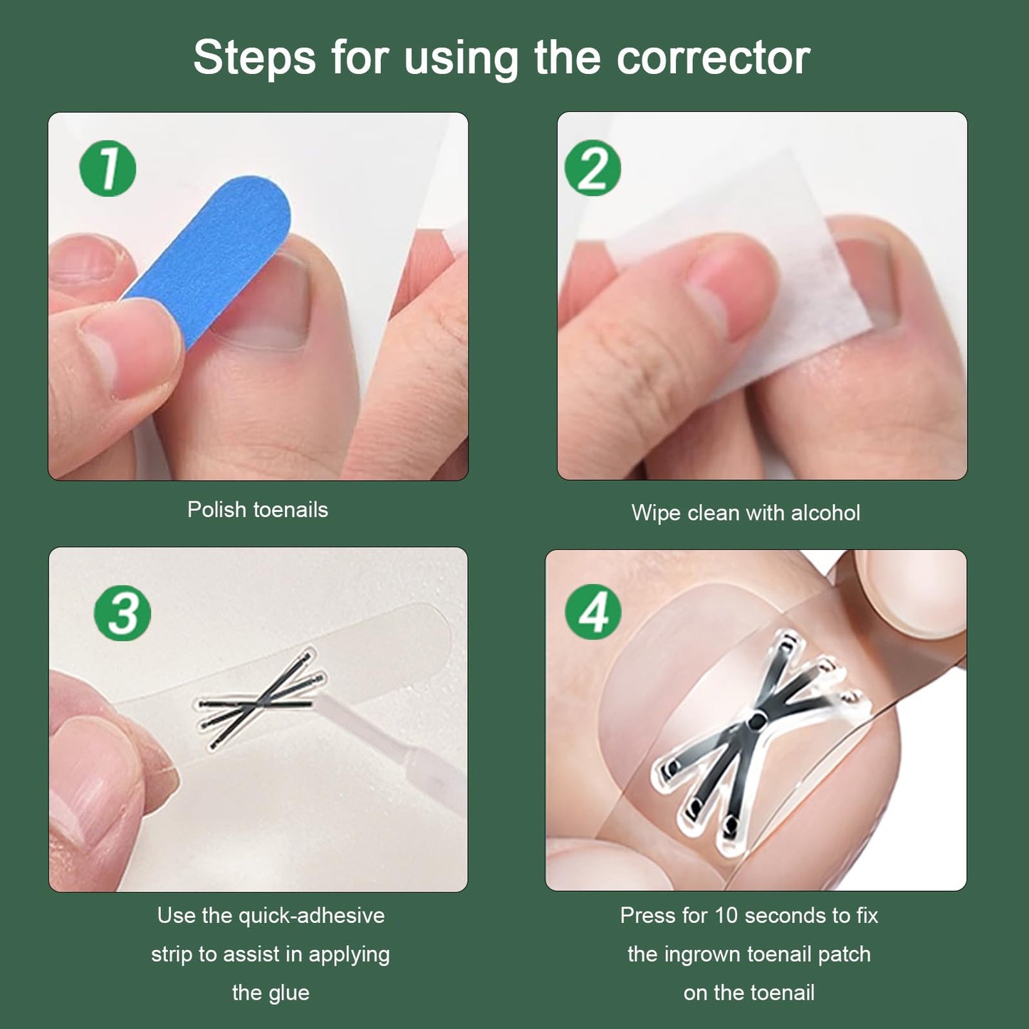 Titanium Alloy Ingrown Toenail Treatment 3X Stronger Pulling Force, Nail Tools and Ingrown Toenail Repair Kit for Curved & Thick Nails, Professional Foot Care Solution for Men & Women (0.63/0.67 in)