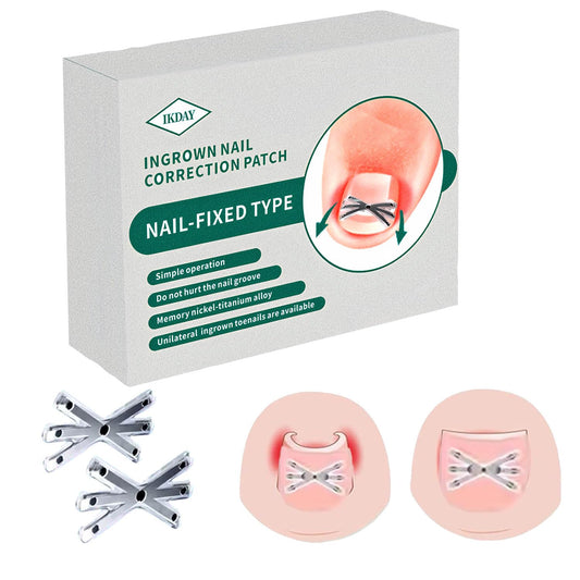 Ingrown Toenail Treatment & Removal Kit (New 6X Tension) at Home Treatment for Toenails,Titanium Alloy Ingrown Toenail Corrector, Nail Tools for Curved Nail Repair for Men Woman (0.67/0.79in)