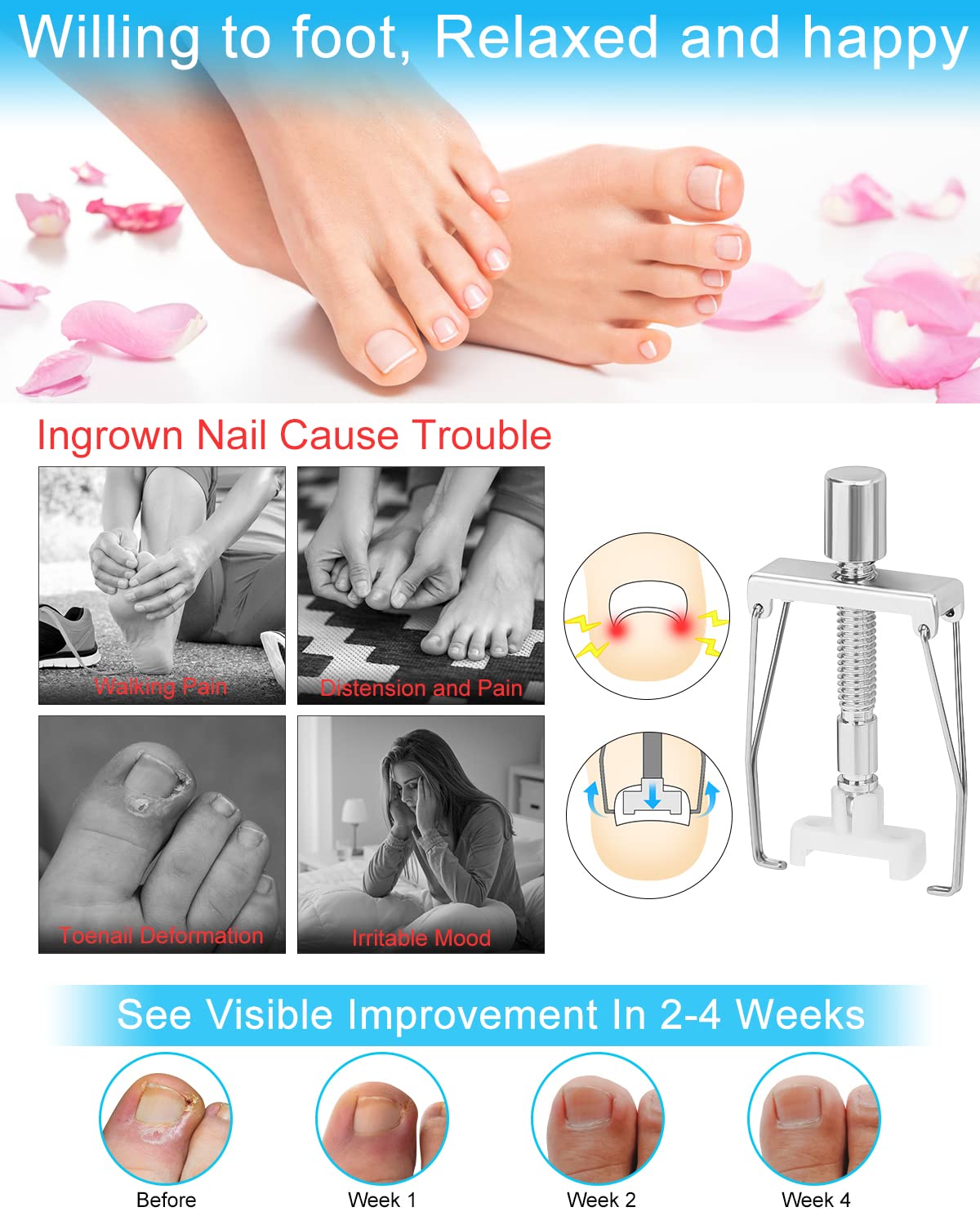 BLATOWN Ingrown Toenail Removal Kit, Ingrown Toenail Treatment, Ingrown Toenail Corrector Tools Come with Podiatry Toenail Braces, Ingrown Toenail Corrector Strips and Patch for Toe Pain Relief