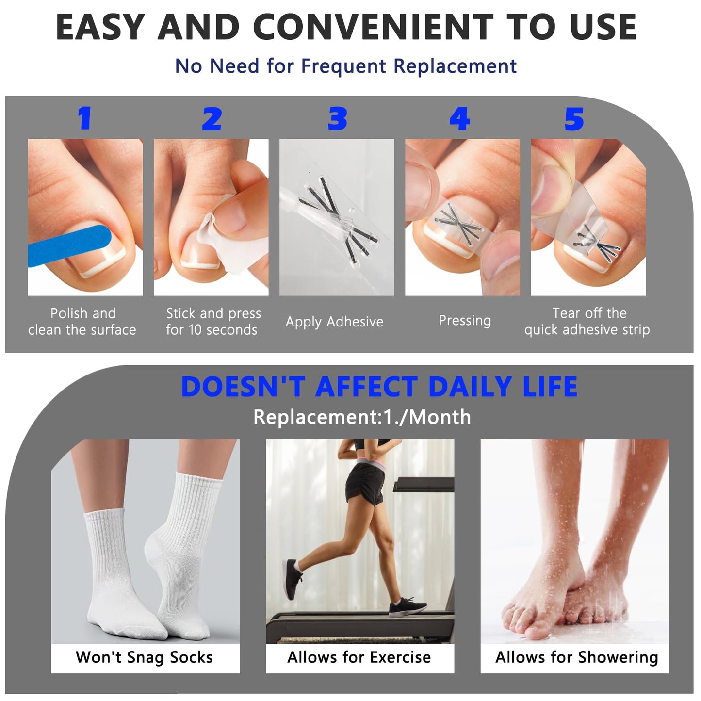 Upgraded MI-shaped Design Titanium Alloy Ingrown Toenail Corrector for Quick Pain Relief, Ingrown Toenail Treatment and Removal Tool Kit for Effective Curved Nail Repair, 6pcs