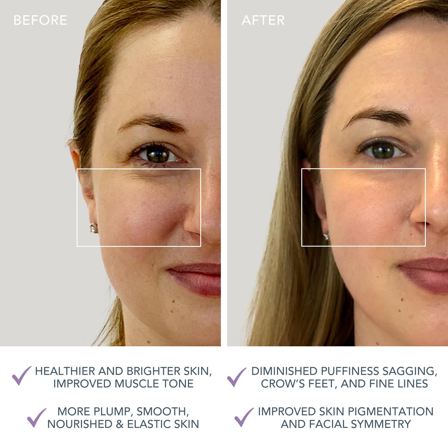 FOREO Bear mini App-Connected Microcurrent Facial Toning Device with 3 Intensities, Lavender