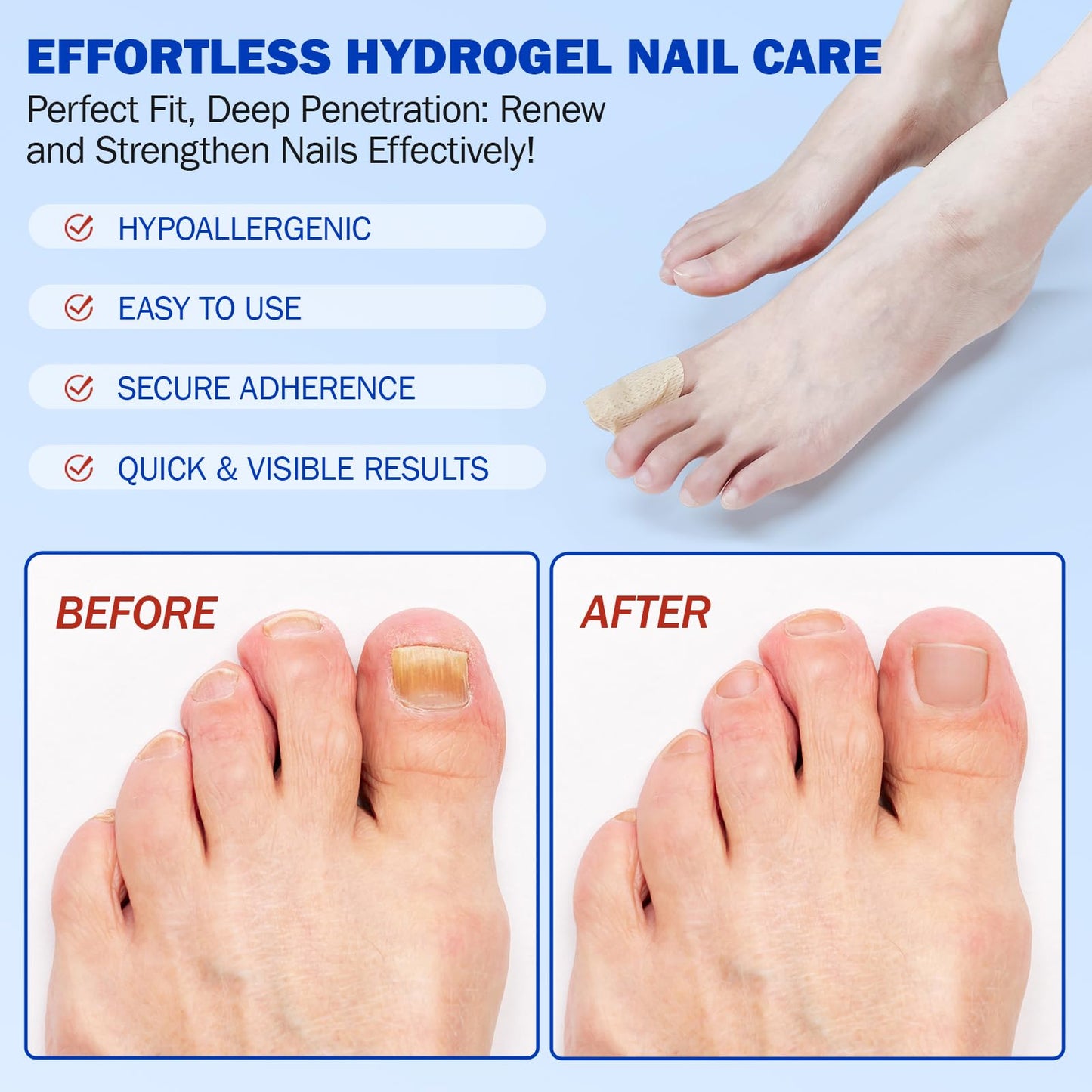 Nail Patches 21 PCS Toenail Treatment Extra Strength 8-Hour Fast Acting Repair Damaged Nails Overnight Nail Repair Effortless Hydrogel Nail Care Renewal for Men and Women