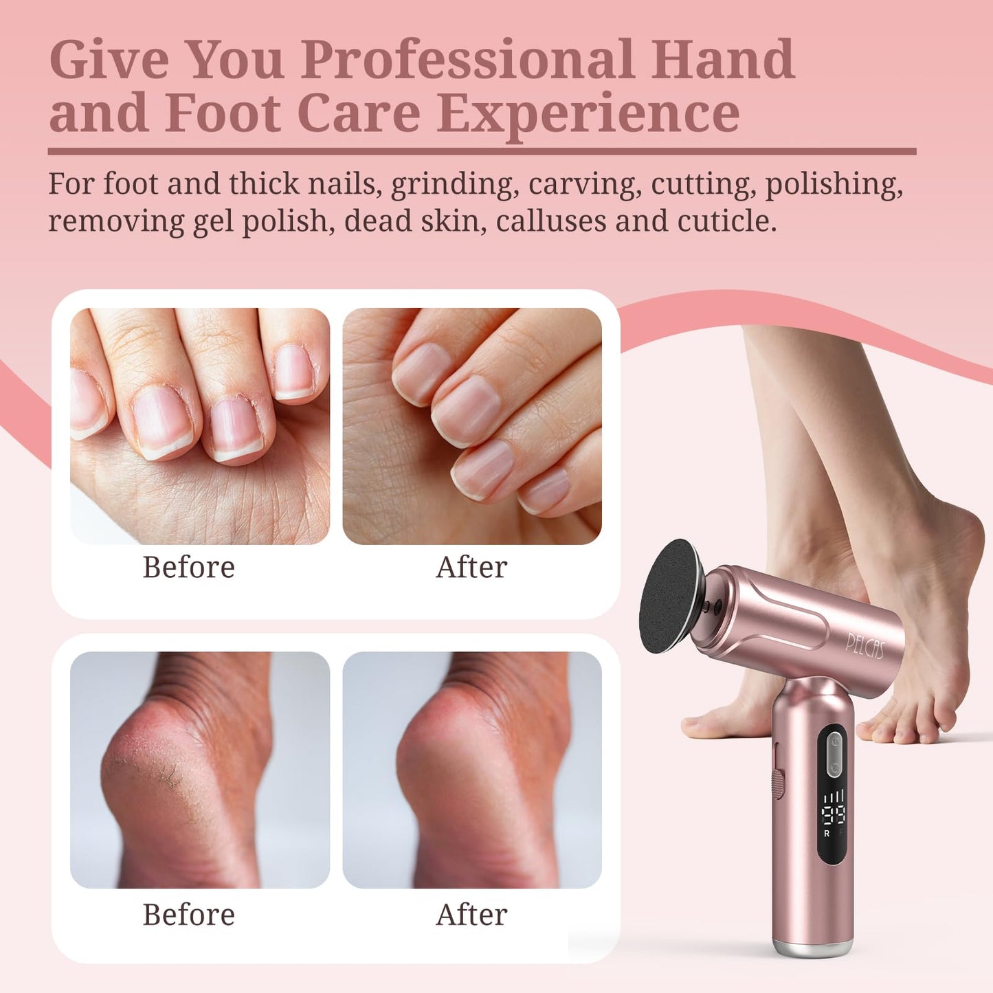 PELCAS Electric Foot Callus Remover with LED Screen, 2 in 1 Manicure & Pedicure Kit, 100 PCS Sandpapers Electric Foot File for Women & Men, Cordless Feet Filer for Foot Callus, Thick Nails Pink