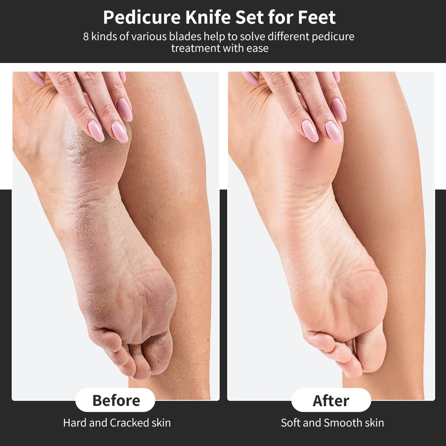 PARTURI Pedicure Knife Kit, 8pcs Black Foot Dead Callus Remover Stainless Set, Professional Ingrown Toenail Steel Tools, Feet Skin Care Nail File Tool Manicure Clippers Cuticle Scraper Toe Shaver