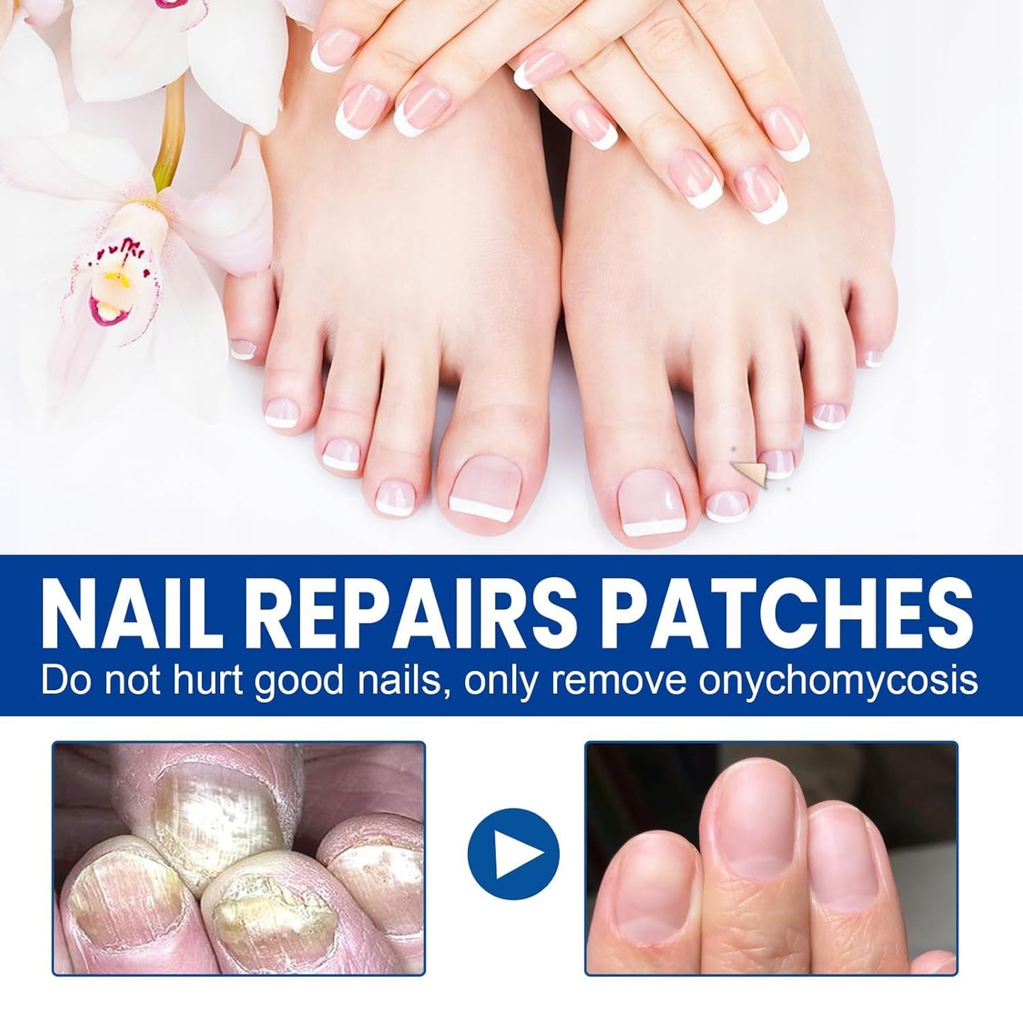 Toenail Fungus Treatment Extra Strength, 60Pcs Fungal Nail Patches for Damaged Nails, 8-Hour Nighttime Renewal & Natural Hydrogel Nail Repair Patches