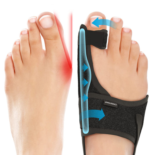 Caretras 2-Pack Bunion Corrector for Women & Men, Orthopedic Bunion Splint for Hallux Valgus Pain Relief, Big Toe Separator, Adjustable Day/Night Support, Comfortable Hammer Toe Straightener
