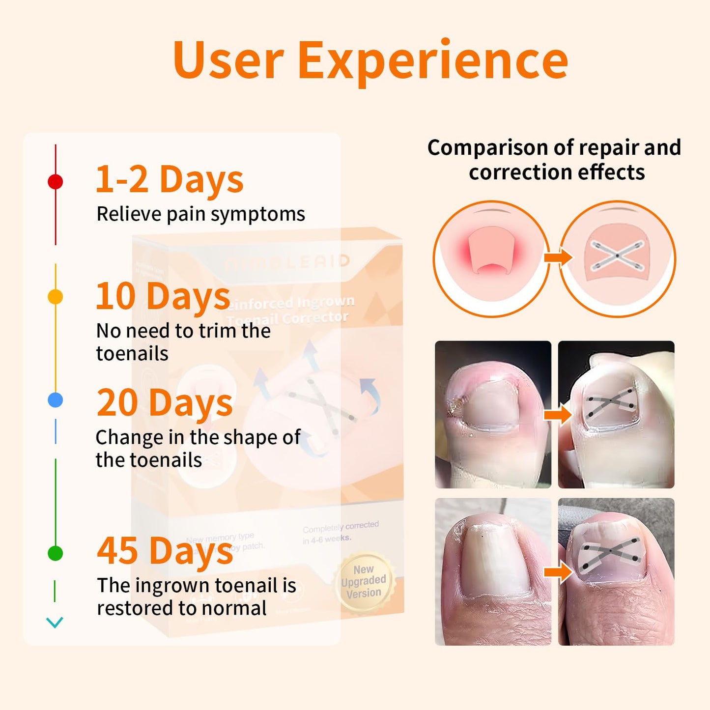 X-Shaped Upgrade Titanium Alloy Ingrown Toenail Corrector,At Home Ingrown Toenail Treatment for Man and Women,Ingrown Toenail Removal Kit,Curved Toenail Straightener (Large Size)