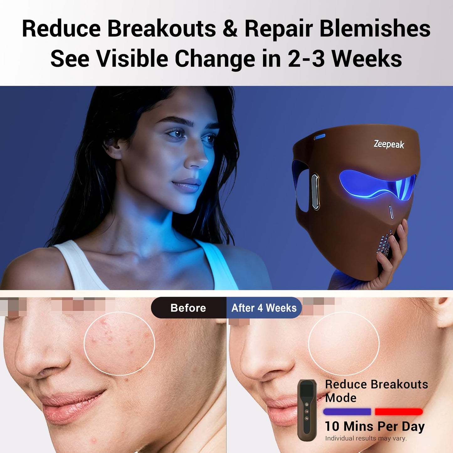 Zeepeak 3D LED Red Light Therapy Mask, FDA-Cleared, 360 LEDs, Anti-Aging & Blemish Repair, 5 Modes Red, Blue, Yellow with 850nm & 1072nm Dual-NIR, Eye-Protection, Portable Design for Home Travel