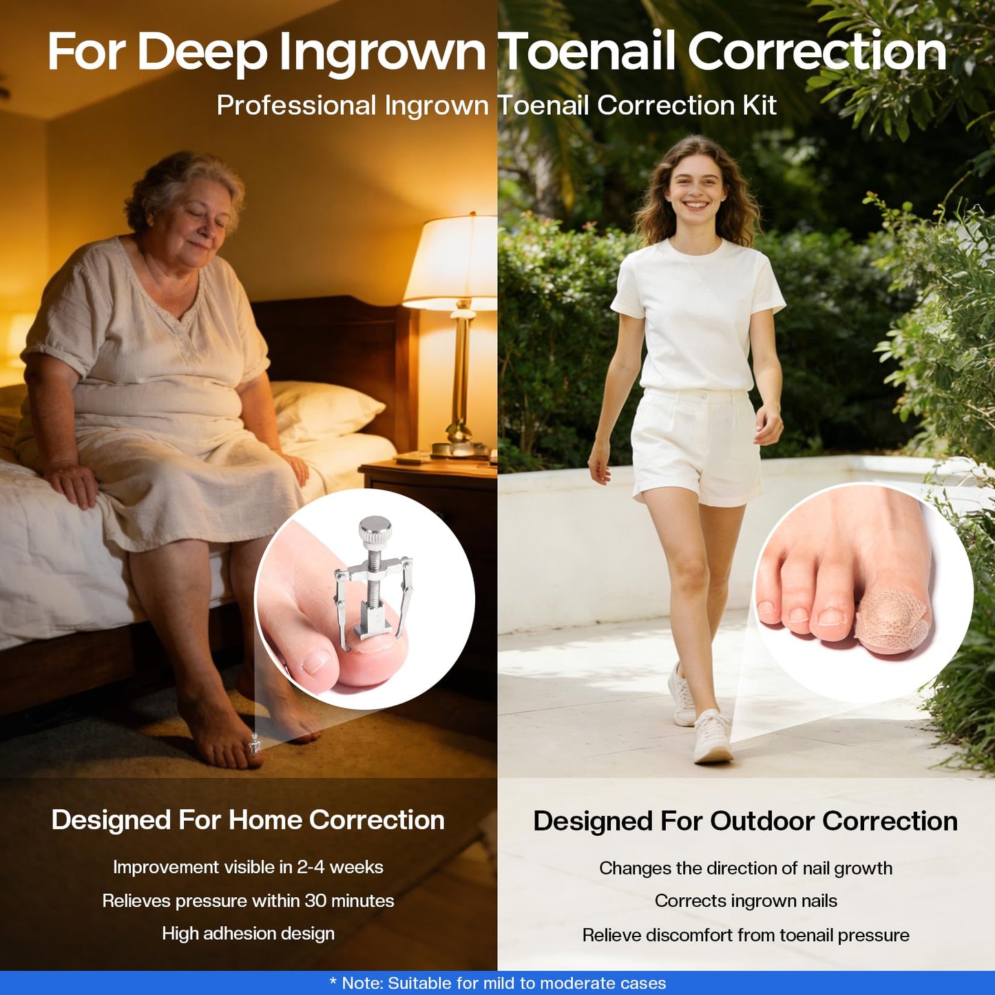 Glamonade Ingrown Toenail Removal Kit: Complete Ingrown Toenail Tool With Corrector Patch And Relief Softening Drops For Soothing Comfort, At‑Home Professional Kit For Men & Women with Curved Toenails