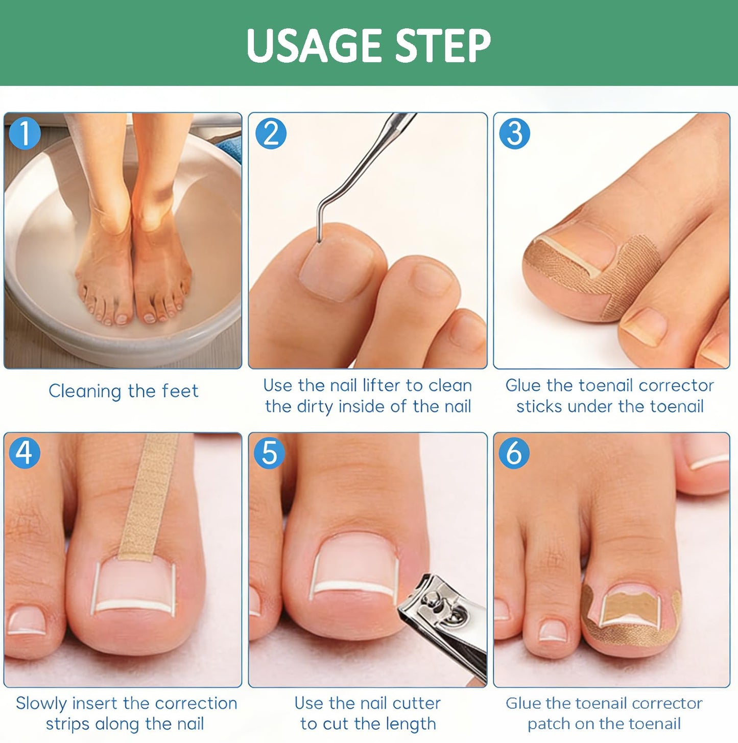 tituouou Professional Ingrown Toenail Treatment Set with Breathable Ingrown Toenail Strips,Ingrown Toenail Removal Kit,Curved Toenails Corrector Patch, Ingrown Toenail Corrector Tool Set for Home Use