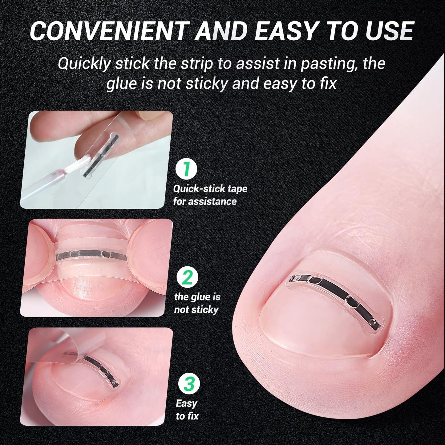 Reieset Titanium Alloy Ingrown Toenail Treatment, Nail Tools, and Ingrown Toenail Removal Kit Specially Designed for Curved Nail Repair and Ingrown Toenail Corrector (0.59/0.67in)