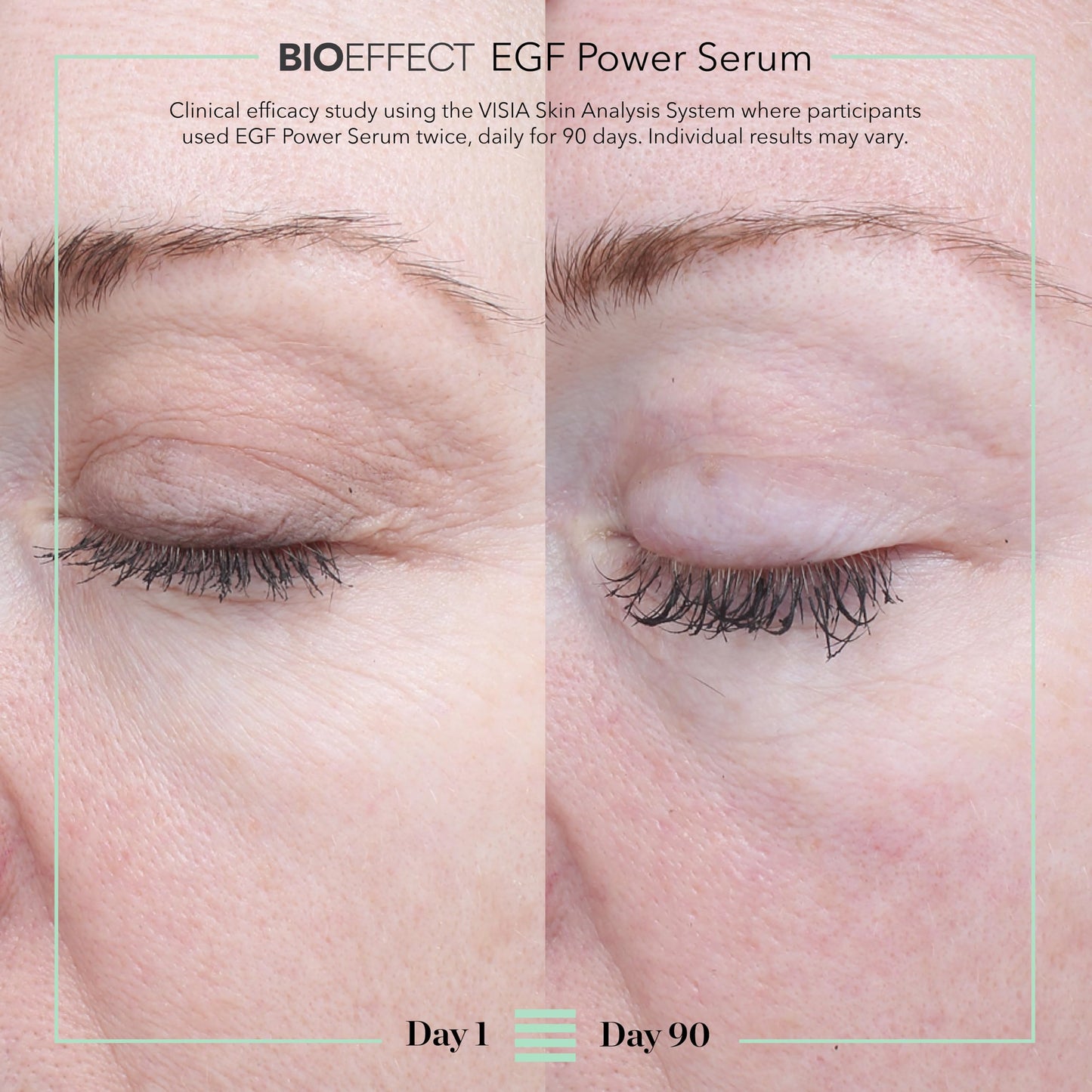 BIOEFFECT EGF Power Serum | Epidermal Growth Factor + KGF + Hyaluronic Acid | Intensive Age-Defying Face Treatment for Deep Wrinkles, Firmness & Skin Renewal, 15 mL / 0.50 oz