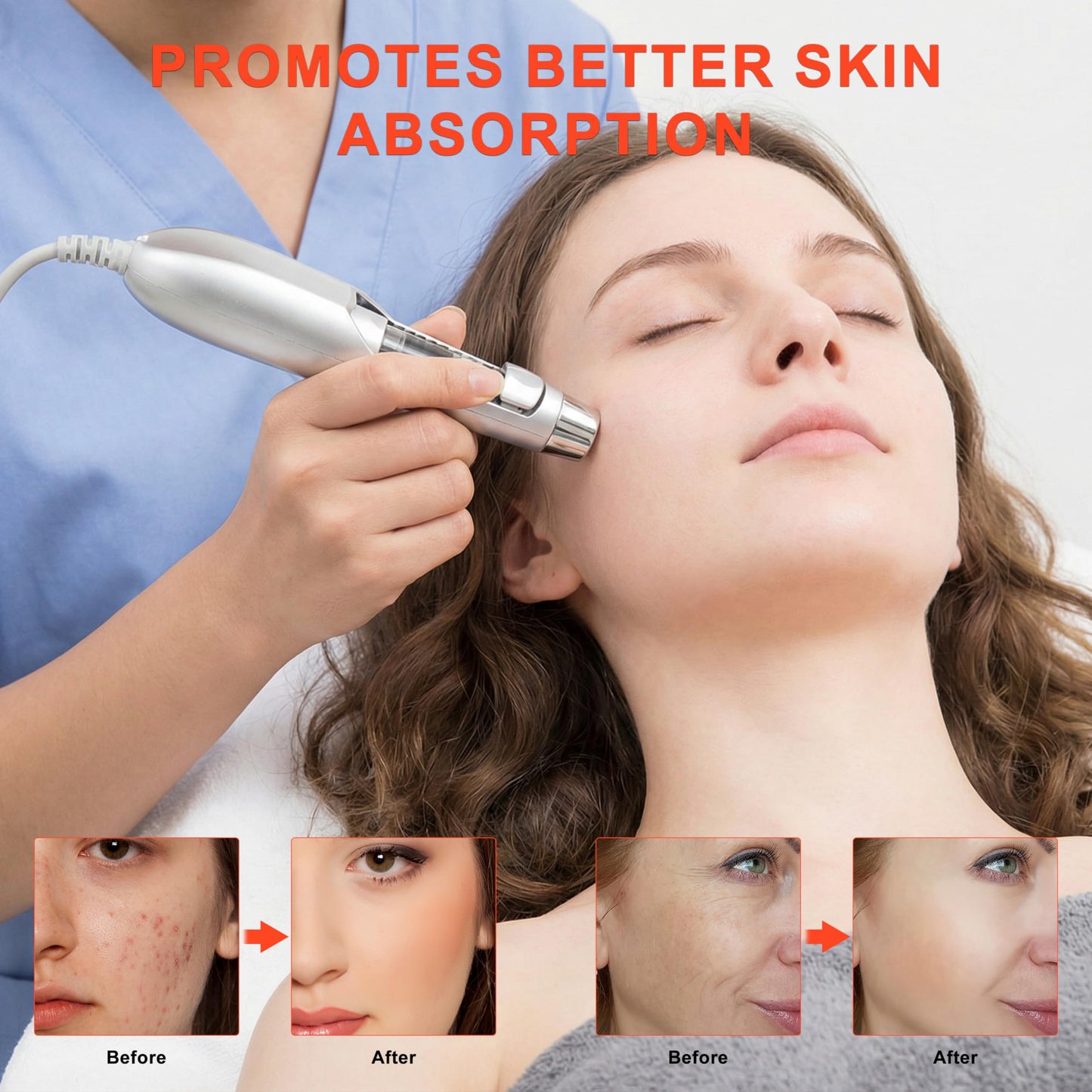 Elitzia ETF49E Needle-Free Electroporation Facial Device Mesoporation Ion-Importing Facial Beauty Machine - Wrinkle Removal Skin Whitening & Moisturizing