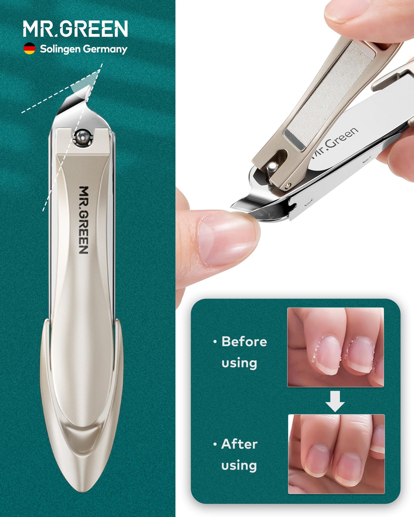 MR.GREEN 4Pcs Nail Clipper Set, Upgraded Anti-Splash Nail Clippers with Nail File and Tweezers, German Stainless Steel Professional Nail Cutter Portable Nail Care Kit with Leather Case for Men & Women