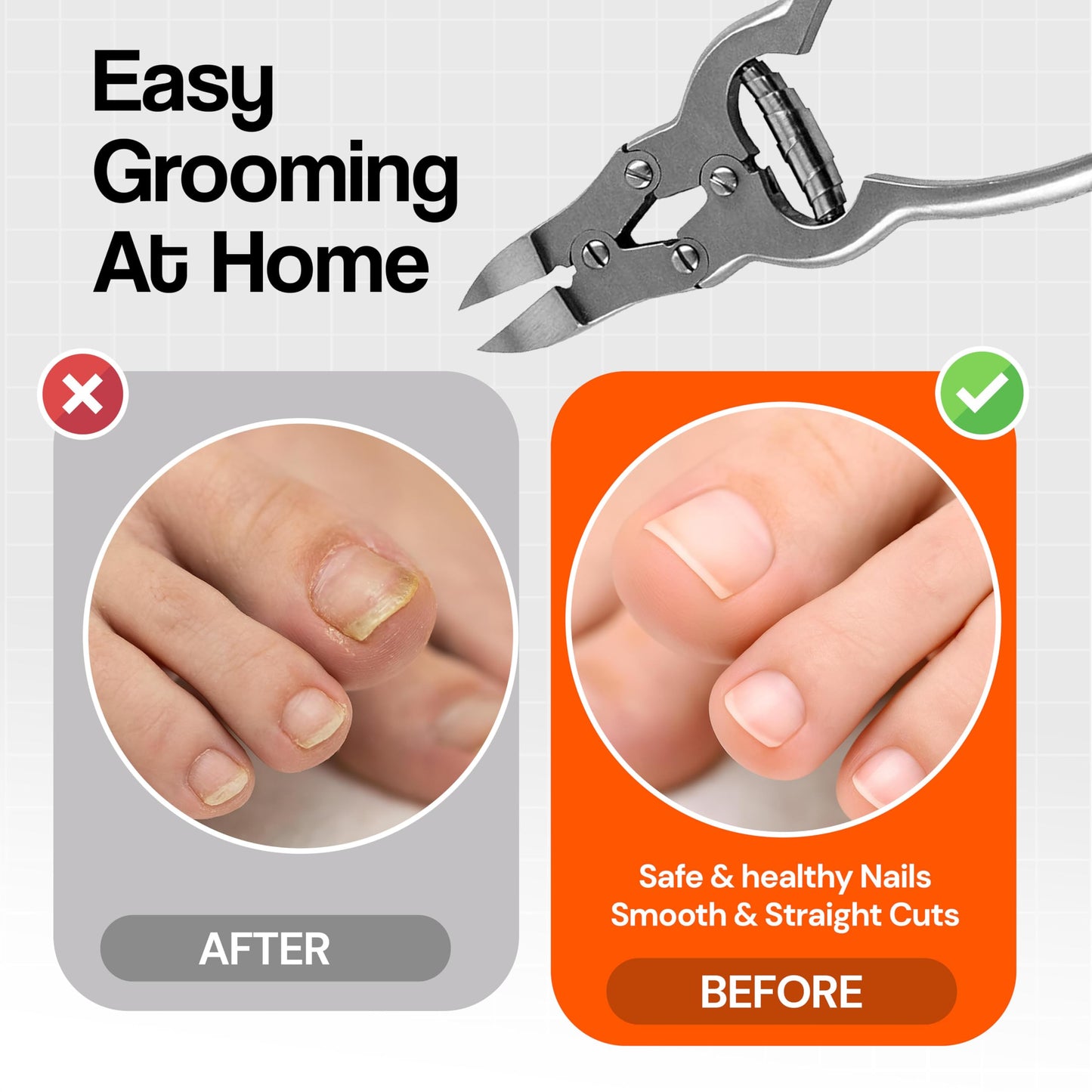 Toenail Clippers for Thick Ingrown Toenails - Professional Podiatry Nail Cutter Fingernail Clipper Trimmer Heavy Duty Surgical Grade Stainless Steel Men Seniors Adults Podiatrist Tool Krisp Beauty