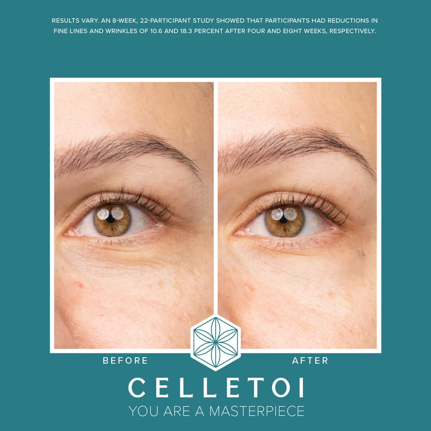 Isagenix Celletoi® Advanced Youth Serum - Firming, Correcting, Dermatologist Tested - Cruelty Free, Vegan - Helps Improve Skin Elasticity - Reduces Fine Lines and Wrinkles - 1.0 fl oz