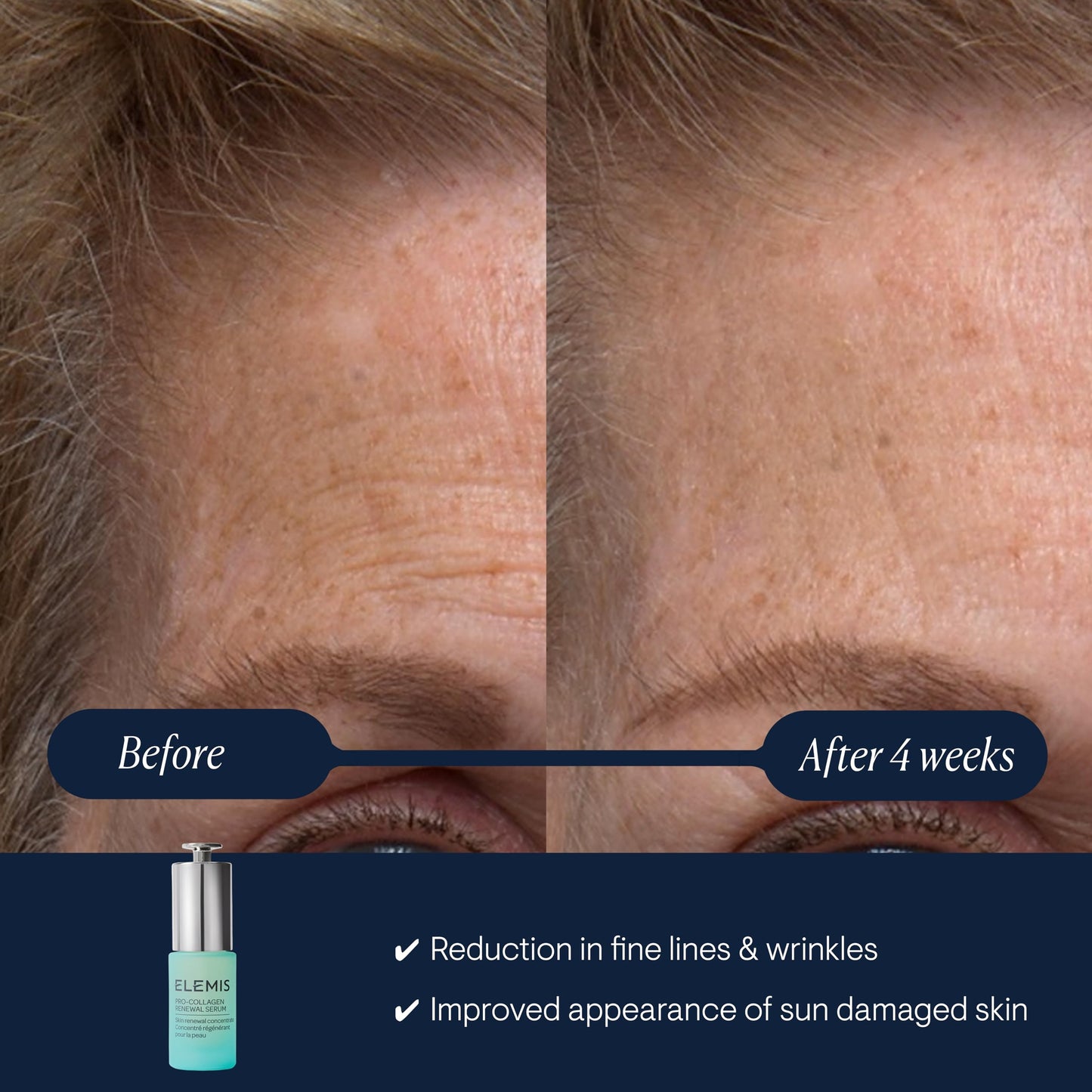 ELEMIS Pro-Collagen Renewal Serum 15ml, Gentle Retinol Alternative for Smoothing Fine Lines & Wrinkles