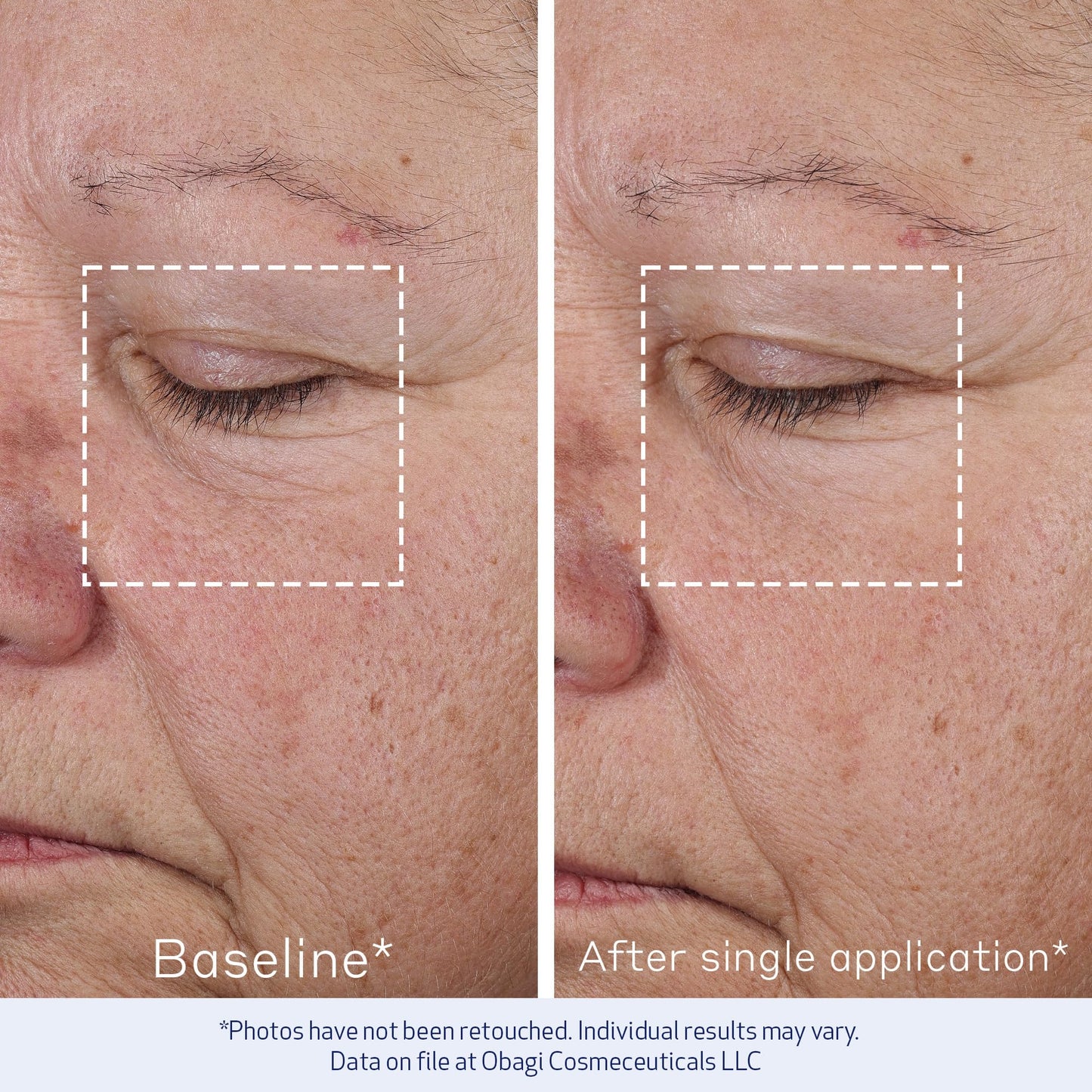 Obagi ELASTIderm Advanced Filler Concentrate – Clinically Proven Non-Injectable Filler with Biomimetic Peptide Technology that Firms Skin & Reduces the Appearance of Fine Lines & Wrinkles – 0.68 oz