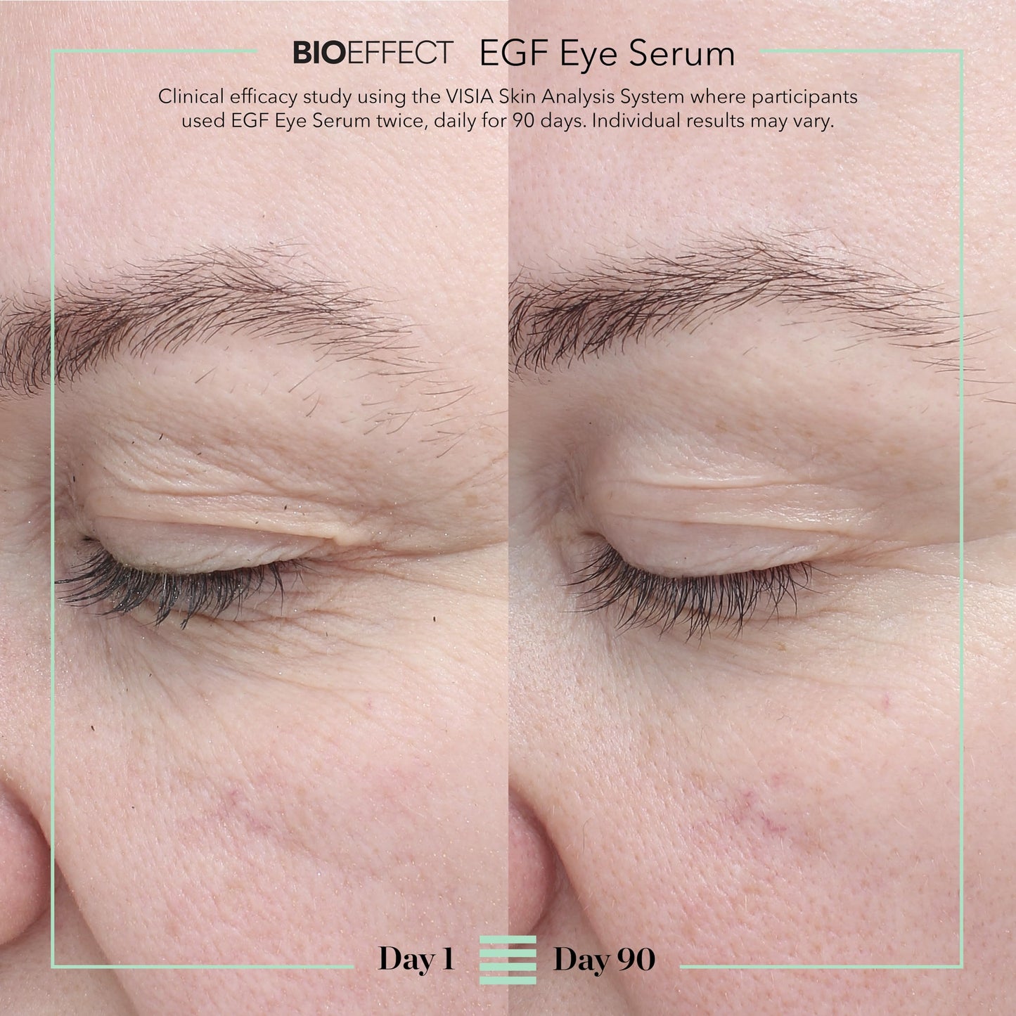 BIOEFFECT EGF Eye Serum with De-Puffer Rollerball | Age-Defying Under Eye Treatment with Epidermal Growth Factor for Fine Lines, Wrinkles, Puffiness & Sagging 6 mL / 0.20 oz